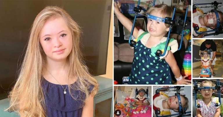 Lekarze nie dawali szans dziewczynce z downem. Ona jednak nie poddała się i w dodatku została modelką.