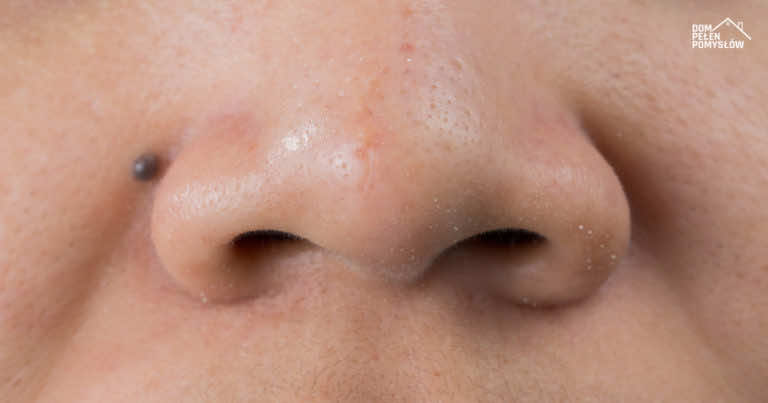 3 dni i problem z otwartymi porami zniknie