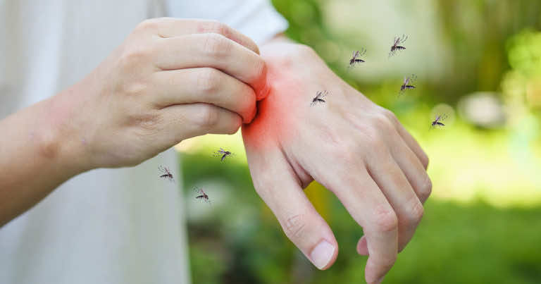 Dlaczego nie drapać ugryzienia komara?