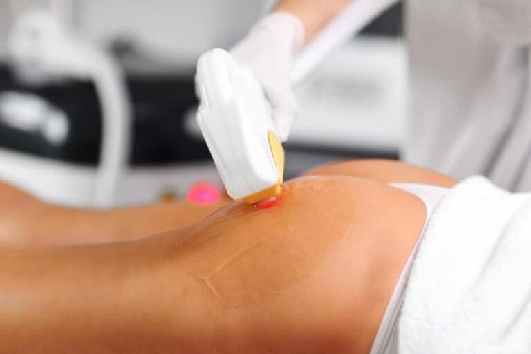 Włosy między pośladkami – jak depilować?