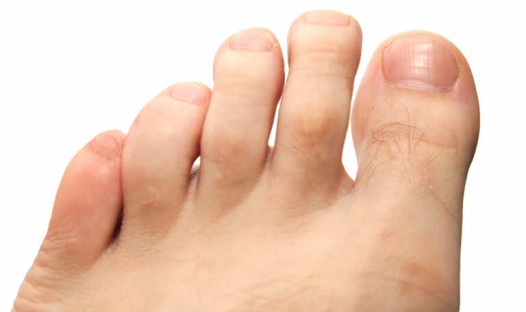 Włosy na palcach u nóg – czy można je depilować?