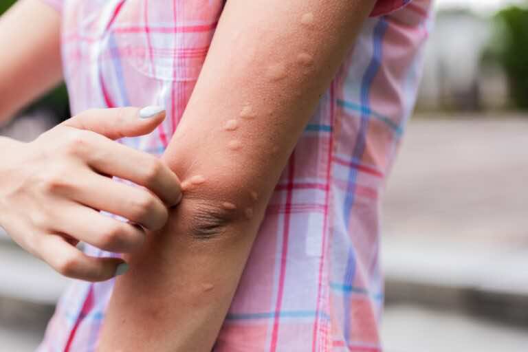 Dlaczego komary nas gryzą, a innych nie?